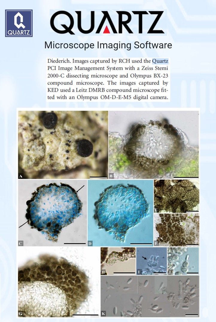Microscope images of Minutophoma buelliarum, a lichenicolous fungus on Buellia lichen, captured with Quartz PCI